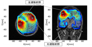 短期記憶課題時の脳活動の推定領域（早大石山研）